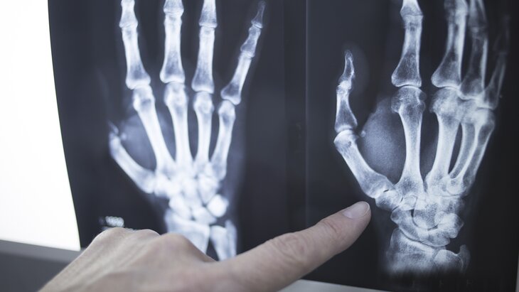 ���������� ������������ � ���������� ���������, ���������� � ���������� ��������